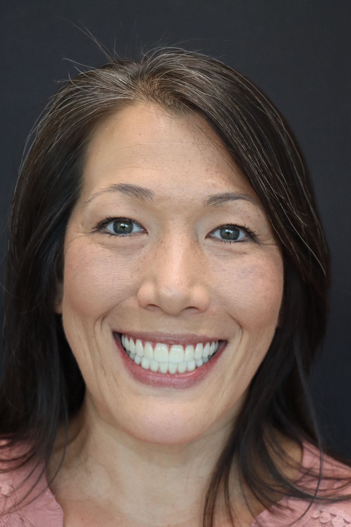 The Dental Atelier Smile Makeover — after treatment, patient 2