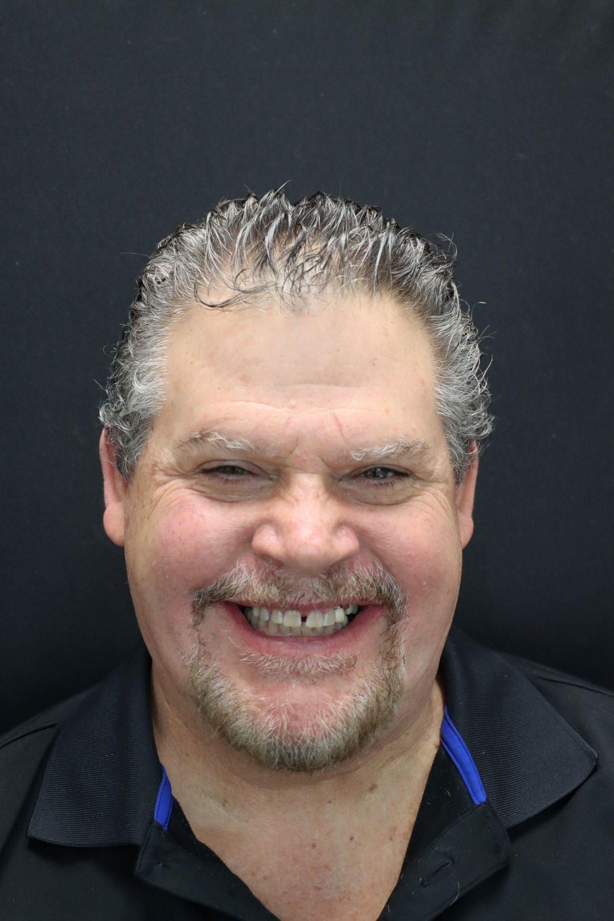 The Dental Atelier Full Smile Restoration — after treatment, patient 3
